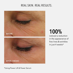 Close-up comparison of eye area before and after 2 weeks of using Power Lift | HydroPeptide showing visible reduction in fine lines and wrinkles on real skin.