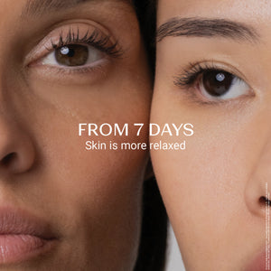Close-up of two women's faces side by side, showcasing smooth and relaxed skin after using Retinol-Like Bi-Serum | Yon-Ka Paris for seven days.