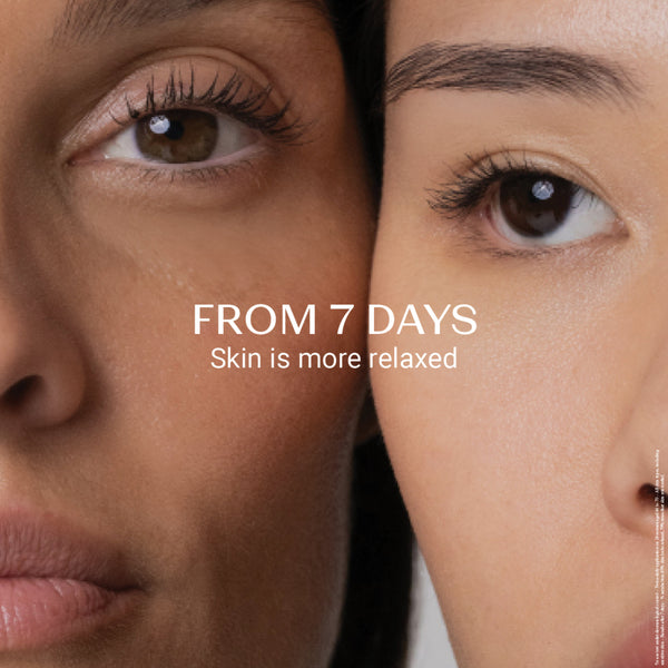 Close-up of two women's faces side by side, showcasing smooth and relaxed skin after using Retinol-Like Bi-Serum | Yon-Ka Paris for seven days.
