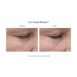 Close-up before and after comparison of a woman's skin around the eye area showing reduced wrinkles and improved texture after using Skin Youth Biome™ | Jane Iredale skincare product.