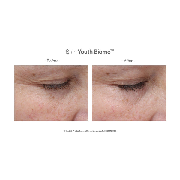 Close-up before and after comparison of a woman's skin around the eye area showing reduced wrinkles and improved texture after using Skin Youth Biome™ | Jane Iredale skincare product.