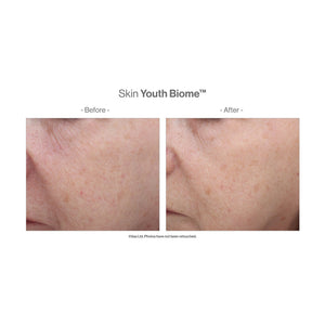 Before and after close-up comparison of facial skin showing improved texture and reduced redness using Skin Youth Biome™ | Jane Iredale skincare product.
