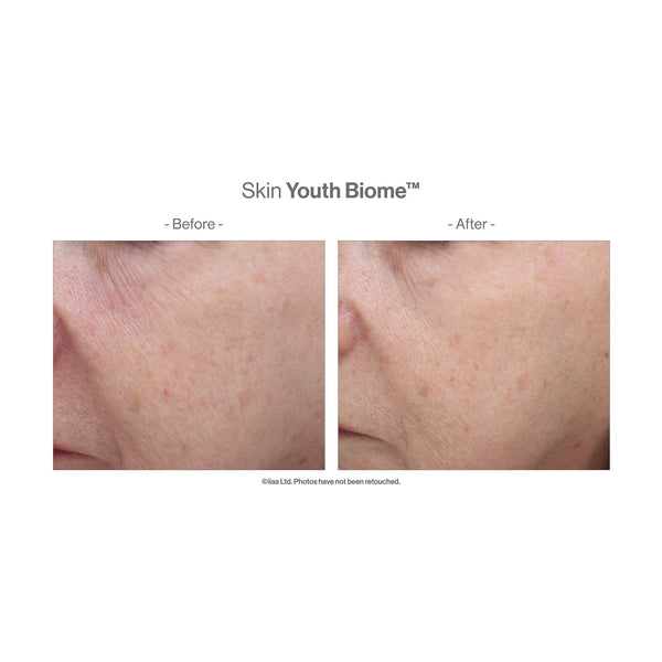 Before and after close-up comparison of facial skin showing improved texture and reduced redness using Skin Youth Biome™ | Jane Iredale skincare product.