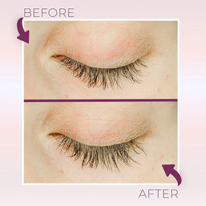 Close-up comparison of closed eyes showing eyelash growth improvement before and after using Lash & Brow Enhancer Serum | Blinc for enhanced skincare results.