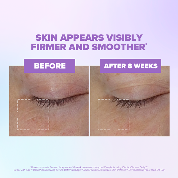 Better With Age™ Renewing Bakuchiol Serum | ClarityRX