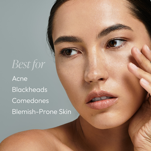 Close-up of a woman with clear, glowing skin gently touching her face next to text highlighting benefits for acne, blackheads, comedones, and blemish-prone skin using Cleansing Gel with Salicylic Acid | Circadia.