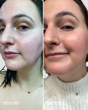 Before and after comparison of a woman’s face showing improved skin texture and glow after using Boost 49% Rosehip Oil Serum | Three Ships for skincare results.