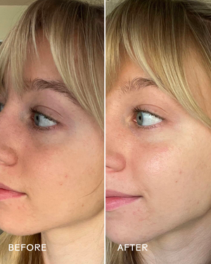 Side-by-side comparison of a woman’s face before and after using Brighter Days Red Algae + Avocado Biodegradable Eye Masks | Three Ships, showing visibly brighter and smoother under-eye skin.