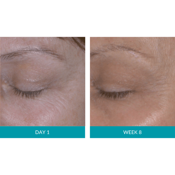 Glo Mask Anti-Aging LED Phototherapy Mask | Glo910