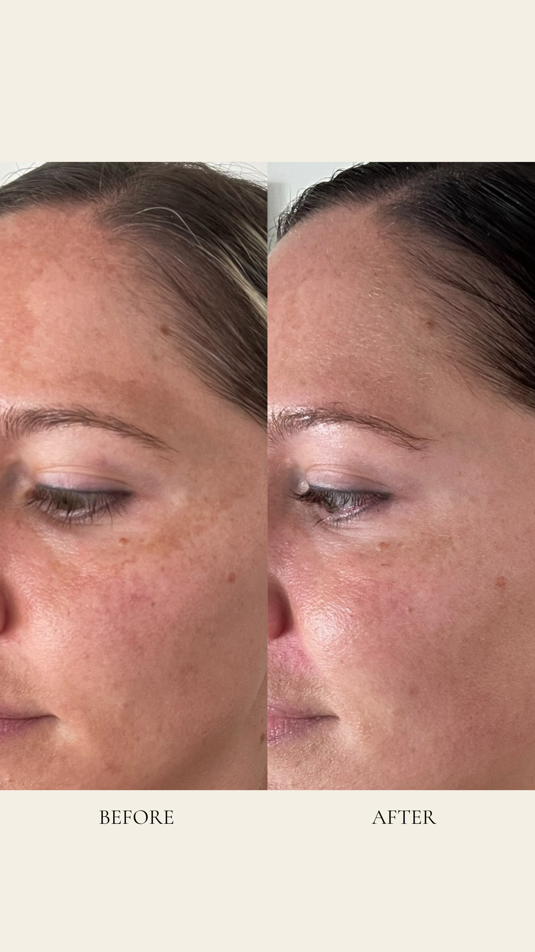 Dose of Glow | prosera