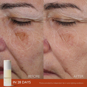 Close-up comparison of a woman's cheek before and after using Elixir | Omorovicza for 28 days, showing a reduction in dark spots and improved skin texture.