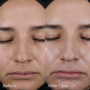 Close-up comparison of a woman's face before and after one use of DAILY PREVENTION Pure Mineral Hydrating Moisturizer SPF 30 | IMAGE Skincare, showing hydrated and nourished skin.