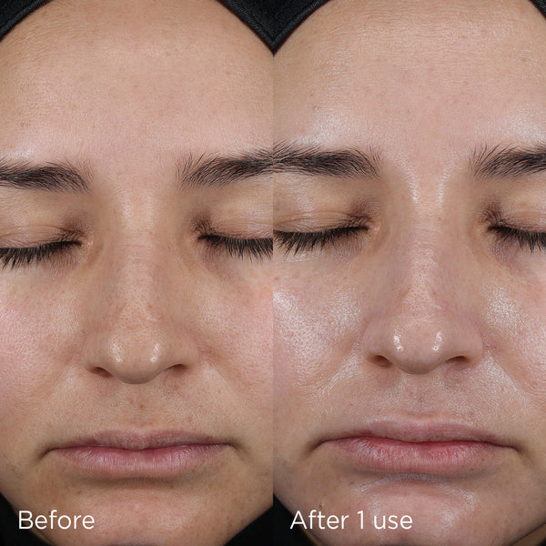Close-up comparison of a woman's face before and after one use of DAILY PREVENTION Pure Mineral Hydrating Moisturizer SPF 30 | IMAGE Skincare, showing hydrated and nourished skin.