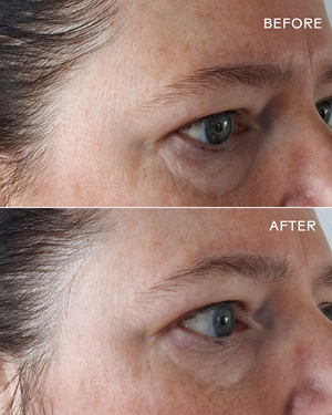 Close-up comparison of a person's eye area showing visible reduction in fine lines and smoother skin after using EyeHero™ Bio-Retinol Smoothing Eye Cream | Three Ships, highlighting skincare results.