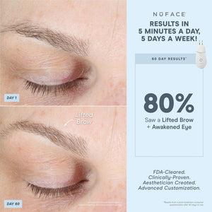 Comparison close-up of a closed eye showing a lifted brow after 60 days of using TRINITY+ Effective Lip & Eye Attachment | NuFACE for skincare results with visible eye area improvement.