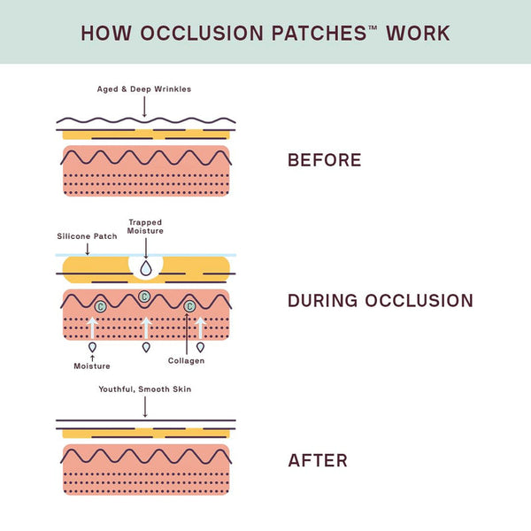 Diagram illustrating how occlusion patches from the Face to Face Bundle | Dermaclara trap moisture with a silicone patch to reduce wrinkles and promote smooth, youthful skin.