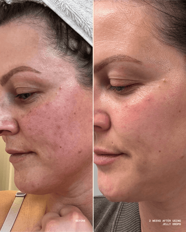 Side-by-side comparison showing a woman's face before and two weeks after using Jelly Drops™ Kakadu Plum + Mushroom Hyaluronic Acid Serum | Three Ships, highlighting visibly smoother and clearer skin.