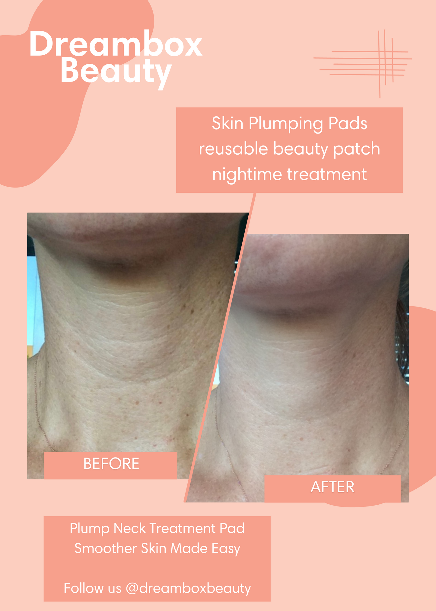 Skin Plumping Neck beauty patch nighttime treatment | Dreambox Beauty