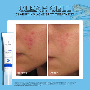 Before and after comparison of facial skin showing reduced redness and fewer acne spots using CLEAR CELL clarifying acne spot treatment | IMAGE Skincare for clearer skin.