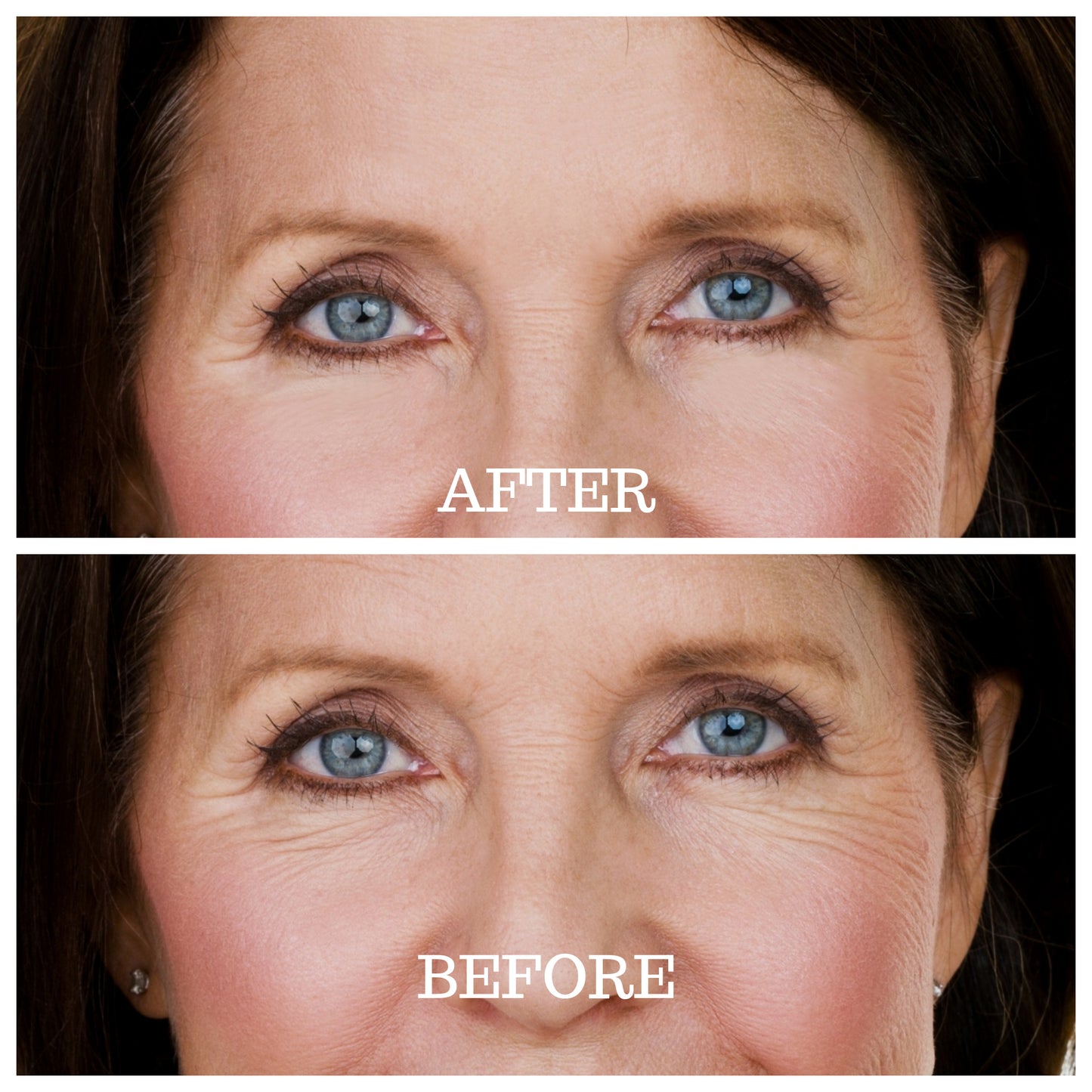 Skin Plumping Eye Pads beauty patch nighttime treatment | Dreambox Beauty